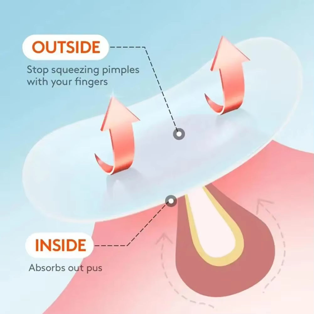 Star Acne Patch Face Care Repair Pimple Acne Spots Pimple Marks Invisible Cover Acne Pimple Repair Anti-Ance Patch Hydrocolloid